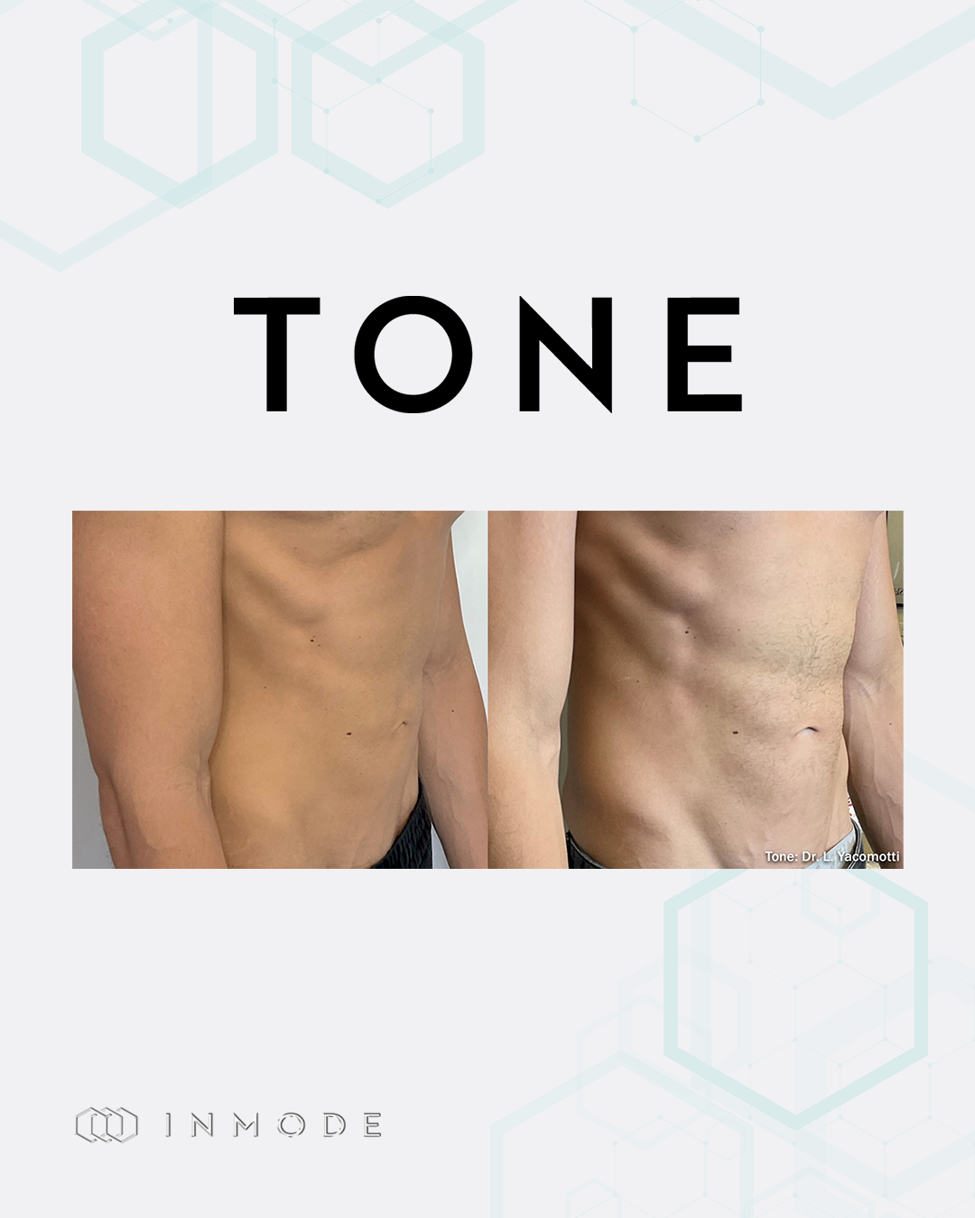 Tone Photo for description